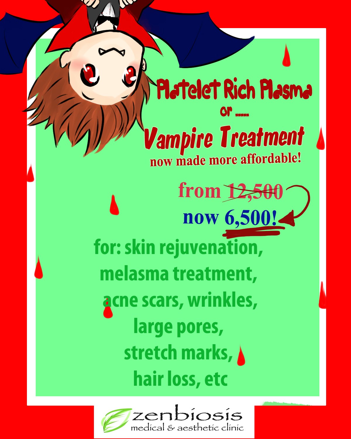 PRP or “Vampire Treatment” Now Made Affordable at Zenbiosis